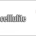 Cos’è la celllulite