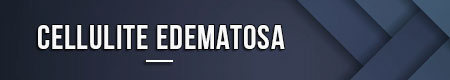 cellulite-edematosa