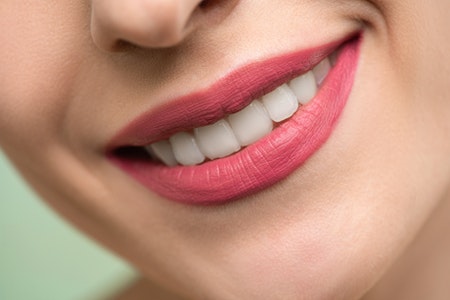 sorriso-bianco-e-senza-denti